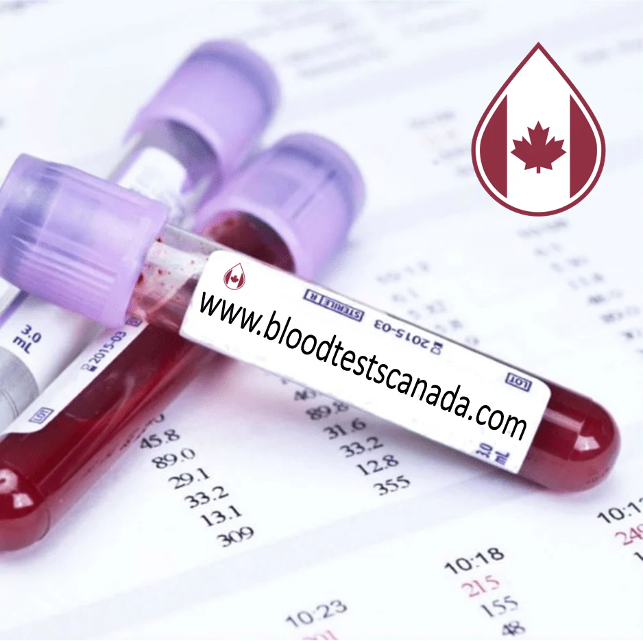 Tests sanguins privés au Québec. - Private Blood Tests in Quebec.